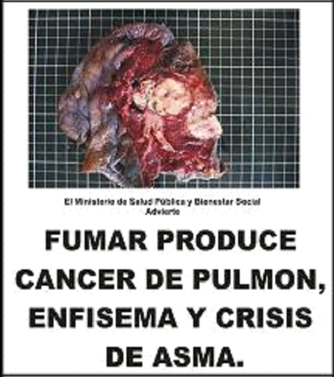 Paraguay 2009 Health Effects Lung - lung cancer, emphysema, and asthma, diseased luung image, gross